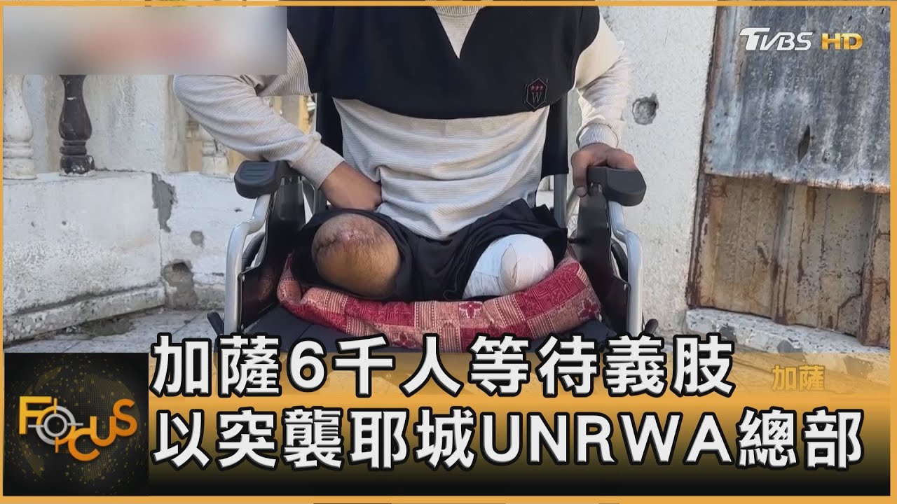 加薩6千人截肢25%兒童 以突襲耶城UNRWA總部