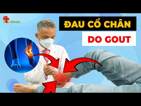 Đau Cổ Chân Do Gout Hành Hạ? Đây Là Cách Giảm Đau Nhanh Chóng!