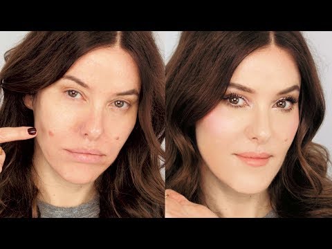 3 Tactics for Dealing with a Large Swollen Blemish