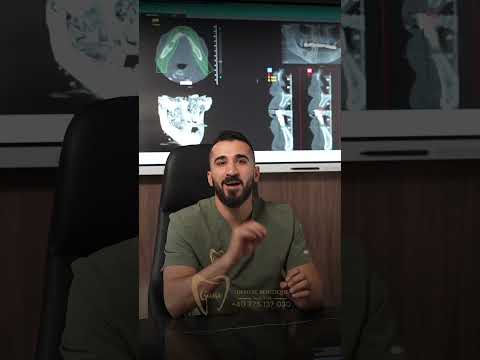 Când dinții se mișcă și nu mai poți mânca bine, este timpul pentru o schimbare