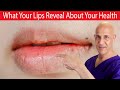 15 Surprising Ways What Your LIPS Can Tell You About Your Health!  Dr. Mandell