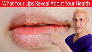 15 Surprising Ways What Your LIPS Can Tell You About Your Health!  Dr. Mandell