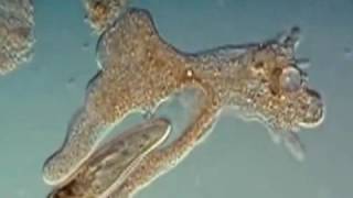 Ameoba vs Paramecium