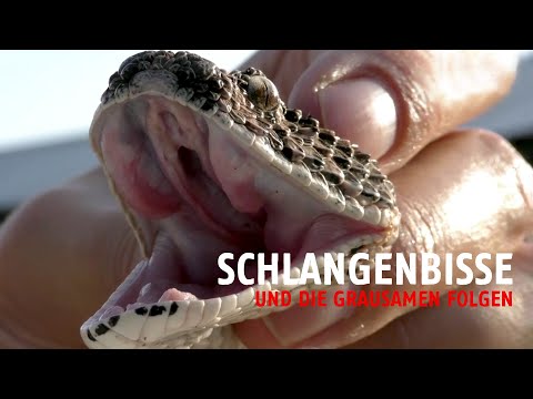 Schlangenbisse – und die grausamen Folgen | Ärzte ohne Grenzen