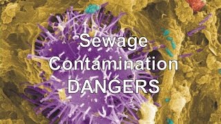 Sewage Contamination Dangers by Jimmy Garza Emergency Water Removal