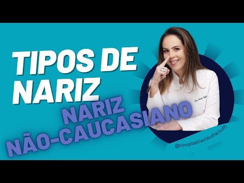 Nariz não caucasiano ( popularmente chamado de nariz negroide)