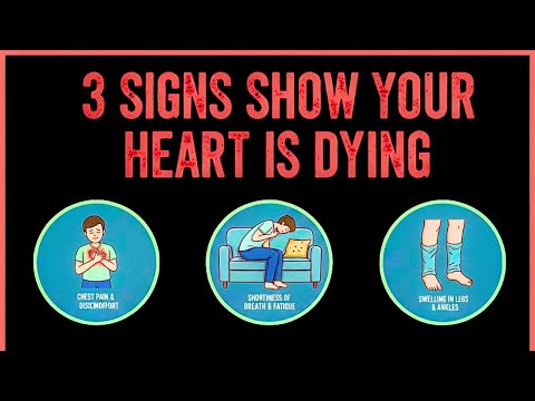 3 Signs Show Your Heart is Dying | Symptoms Health