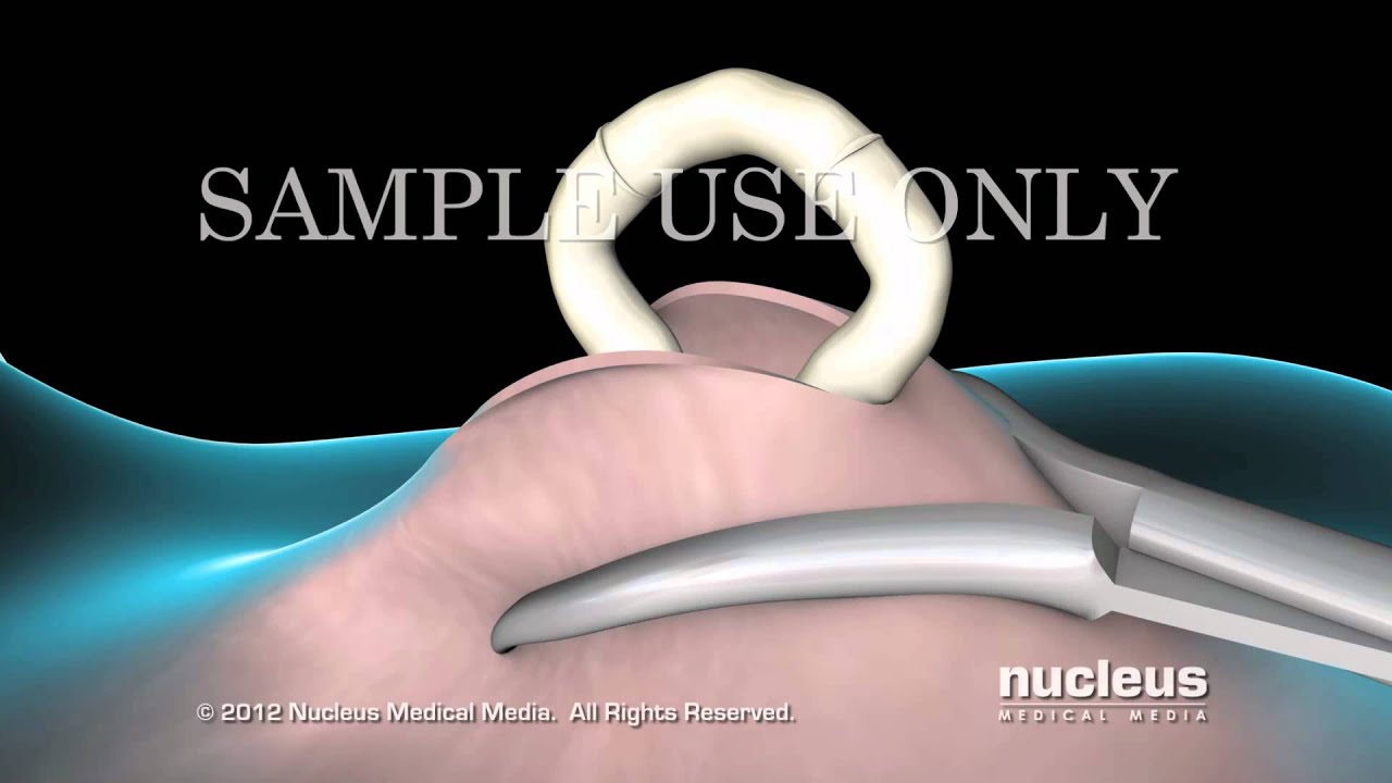Roberto Carlos Castañeda Caballero-22
