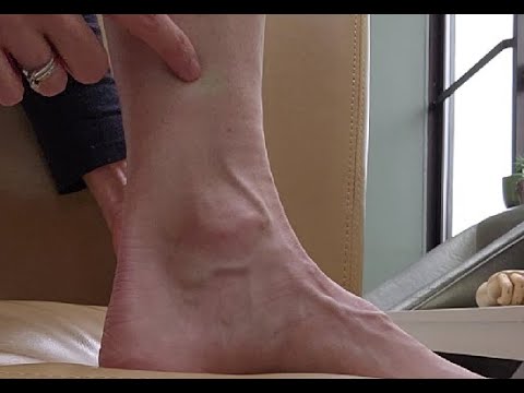 SP6 acupuncture/acupressure point