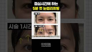 마이크로블레이딩 성형 시술