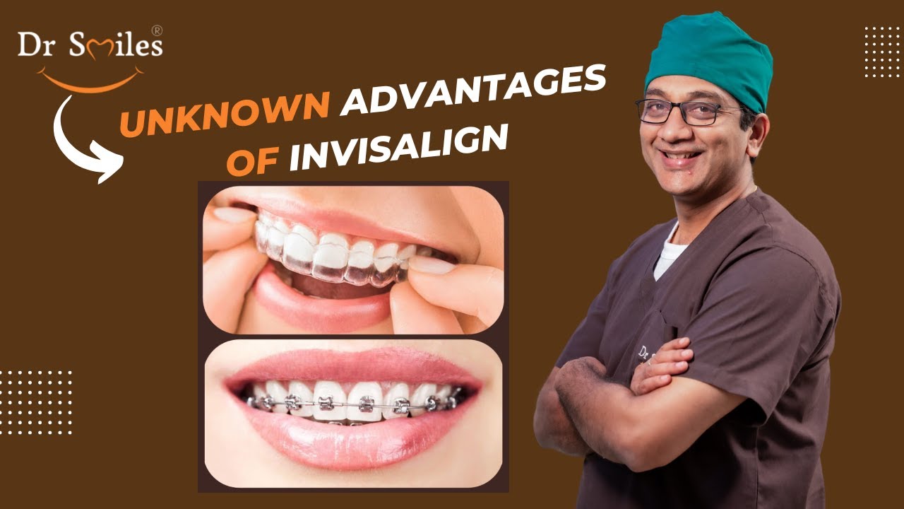 Invisalign: Unknown Advantages | Dr.Kiran Kumar | | Invisalign Treatment Hyderabad | Dr Smiles