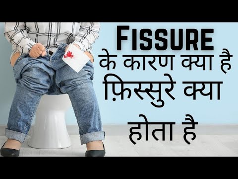 Laser surgery for piles fissure and fistula Laser treatment for piles fissure and fistula benefit