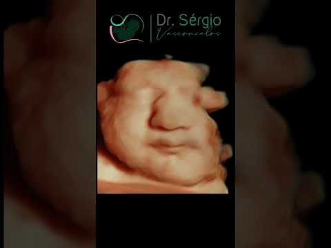 Sérgio De Abreu Vasconcelos Neto-20
