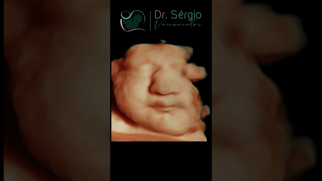 Sérgio De Abreu Vasconcelos Neto-20