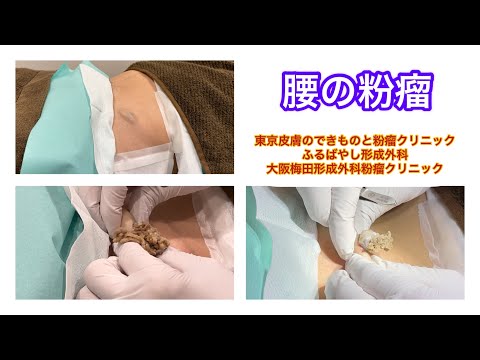 ブレグについて詳しく解説