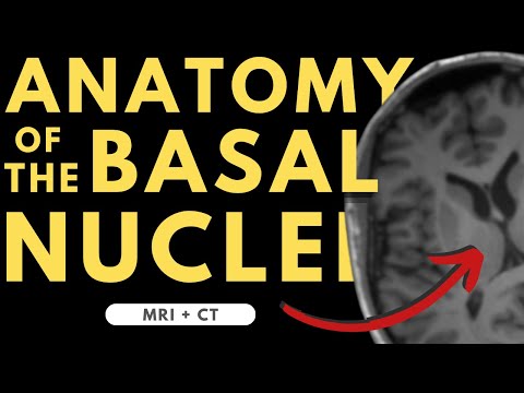 Basal ganglia (basal nuclei) neuroanatomy | Radiology anatomy part 1 prep | MRI + CT