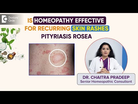 Pityriasis Rosea | Skin Rash & Itching | Homeopathic Remedies - Dr.Chaitra Pradeep | Doctors' Circle