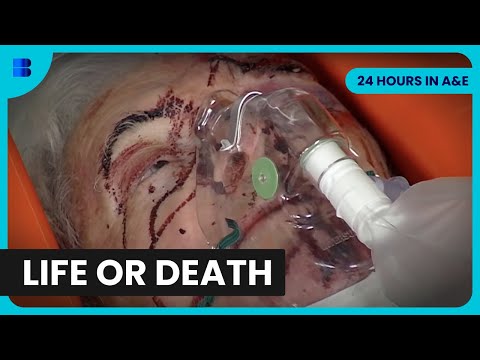 St Georges A&E 24 Hours Life Death Emergency Room | 24 Hours in A&E | Documentary