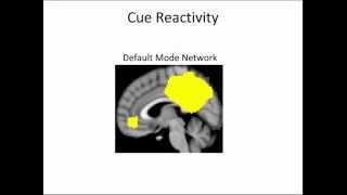 Dr Amy Janes: Cognition and Connectivity:  Neuroimaging Studies of Nicotine Dependence