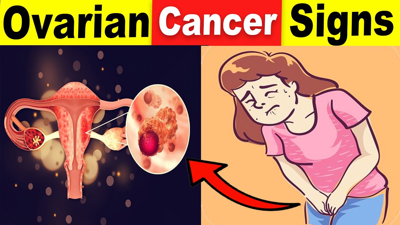 9 Common Ovarian Cancer Signs That You Should Never Ignore