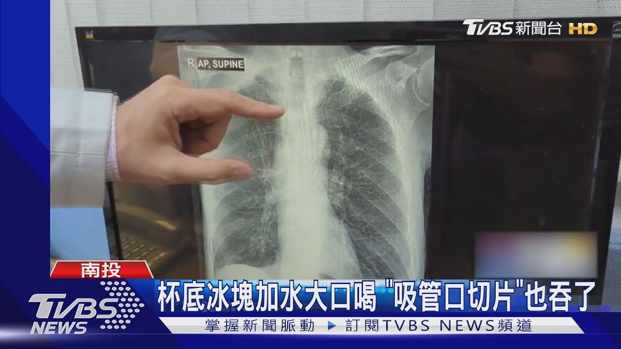 杯底冰塊加水大口喝 「吸管口切片」也吞了