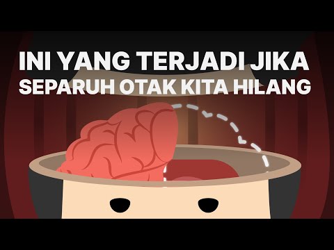 Ini yang Terjadi Jika Separuh Otak Kita Dibuang
