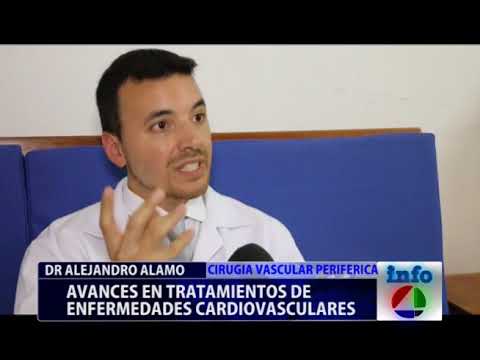 Tratamientos modernos para várices