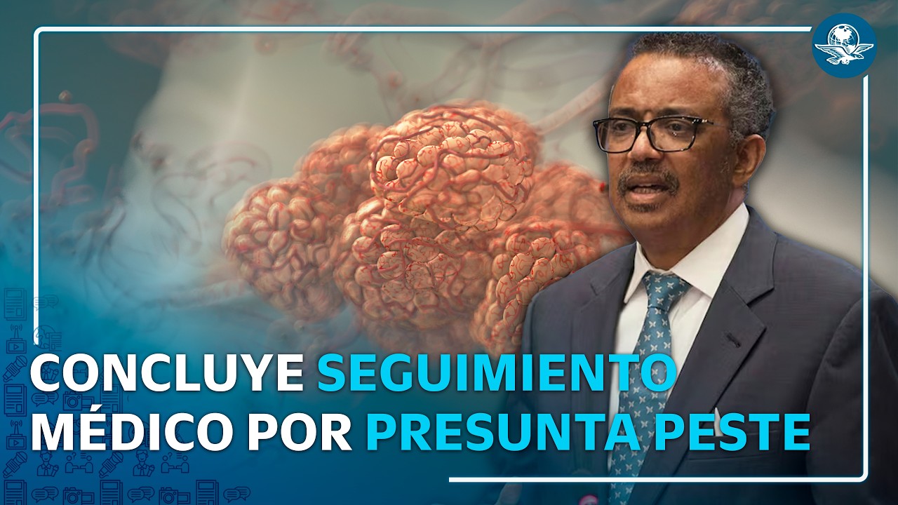 Rusia concluye seguimiento a contactos de científica fallecida sin hallar peste neumónica