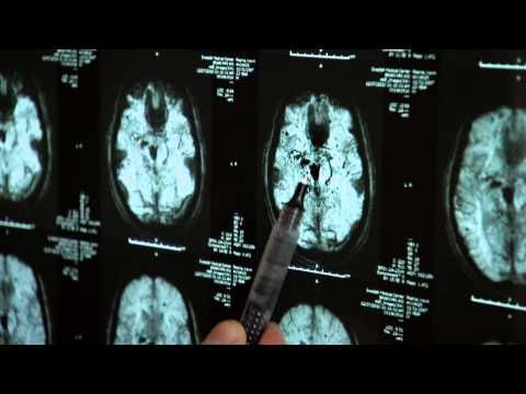 The Crash Reel - Trailer