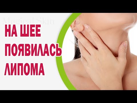 Что нужно есть для работы суставов Сустав тип d