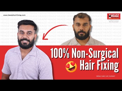 Non Surgical Hair replacement | Hair patch fixing Call 98866 11110