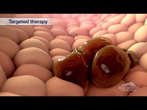 Targeted Therapy for Late-Stage Breast Cancer