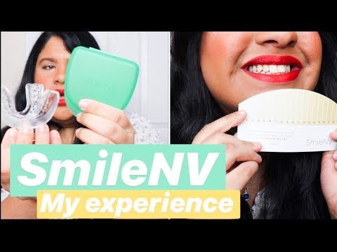 My Experience Using SmileNV Teeth Whitening Kit + Demo