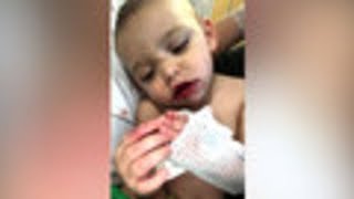 Baby recovering after outbreak of cold sores