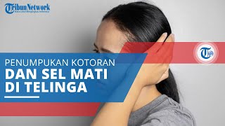 Kolesteatoma, Penyakit Telinga akibat Penumpukan Kotoran dan Sel Kulit Mati dan Bisa Tumbuhkan Tumor