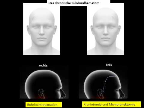 Im unteren Rücken Ursachen Behandlung stechender Schmerz Übungen für die Gelenke und die Wirbelsäule Video-Download