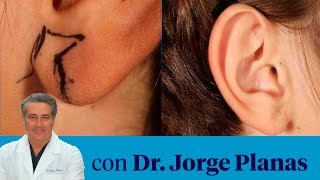 Corpore Sano: Cómo rejuvenecer el lóbulo de la oreja