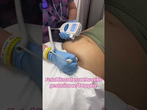 Fetal Doppler Heartbeat of 19 weeks gestation #pregnanttiktok #secondtrimester #mzruizinstructor