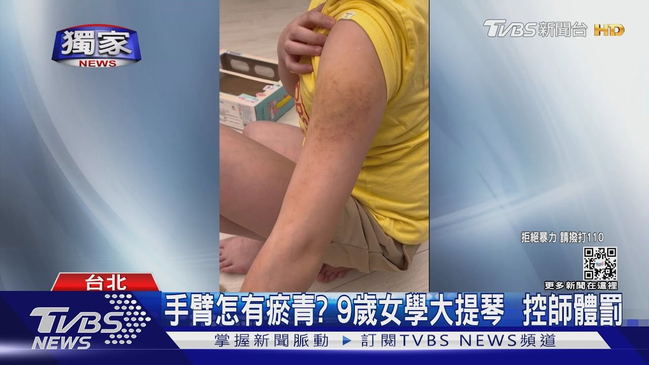手臂怎有瘀青?9歲女學大提琴 控師體罰