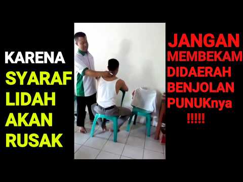 download lagu mp3 mp4 Tutorial Bekam Praktis Untuk Keluarga, download lagu Tutorial Bekam Praktis Untuk Keluarga gratis, unduh video klip Tutorial Bekam Praktis Untuk Keluarga