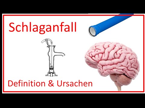 Schlaganfall - Definition und Ursachen