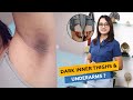 Dark Inner Thighs Underarms Dr Deepika Lunawat