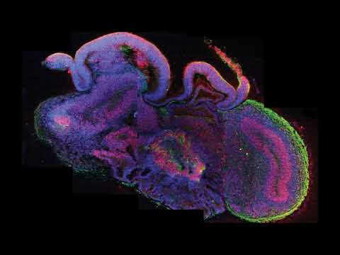 OstrichO - Gedankenbarracke