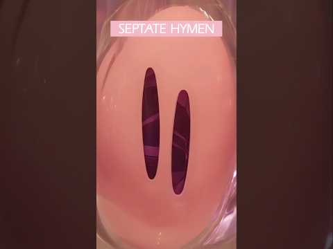 Anatomy & Types of Hymen ❤️ #femalereproductivesystem #pregnancy #menstruation #shorts