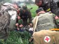 Ампутированные ноги, руки, огнестрельные ранения: Как украинские врачи учатся работать ...