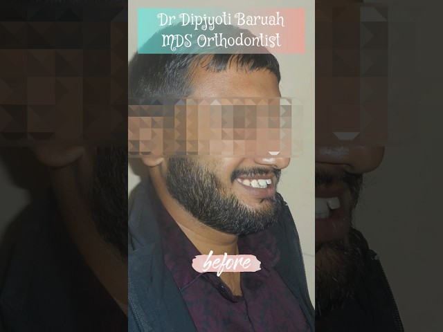 Thumbnail for Post ID: stekq3EJr-0