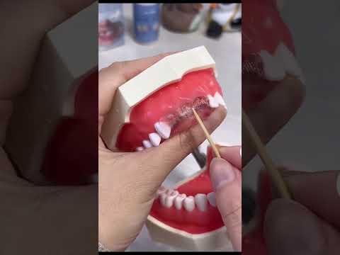 MoldableTeeth материал для временной пломбы для зубов, 20 мл - фото 1 - id-p2798992030