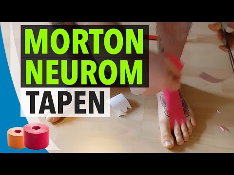 Creme für die Gelenke mit Fett Hai Bewertungen der Ärzte Wunden untere dort auf der rechten Rückseite ist die monatliche