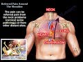 Referred Pain Around The Shoulder - Everything You Need To Know - Dr. Nabil Ebraheim