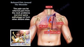Referred Pain Around The Shoulder - Everything You Need To Know - Dr. Nabil Ebraheim